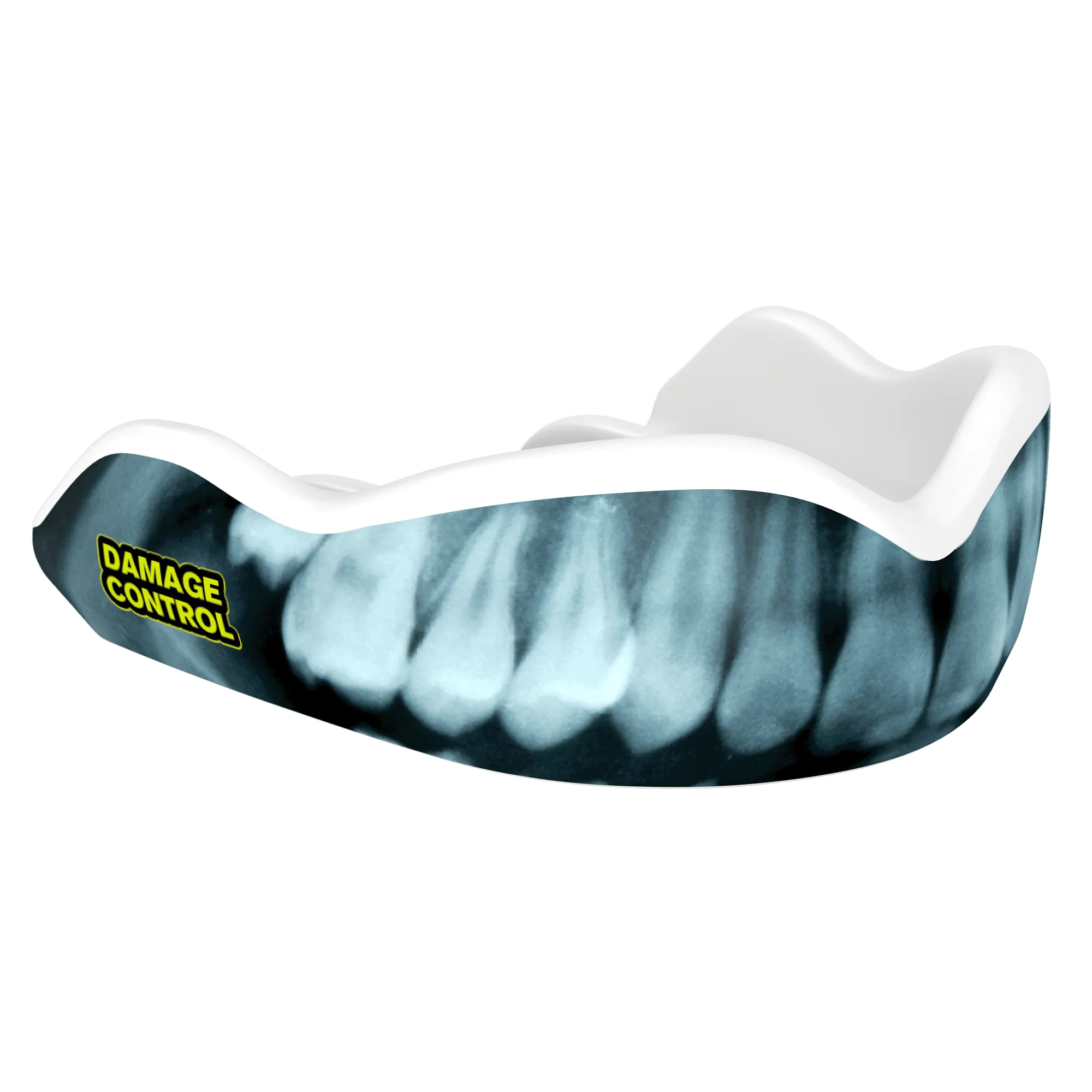 X-Ray Mouthguard (HI) - Image 2